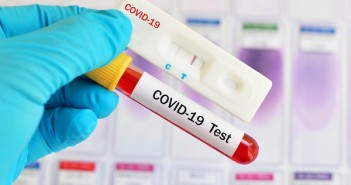 teste-exame-covid-coronavirus